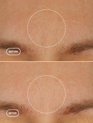 Retinol Alternative Moisturiser